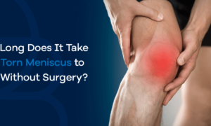 Recovery Timeline After Meniscus Repair Surgery