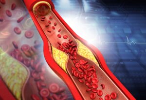 Can Blocked Arteries Repair Themselves? Understanding Arterial Health