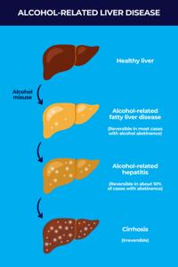 Can Liver Damage Be Reversed?