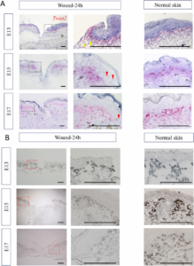 Regeneration of Skin in Mammals: Unique Models and Mechanisms