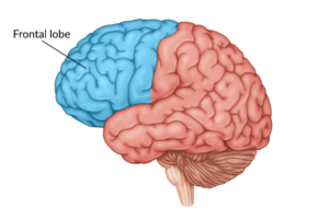 Understanding Frontal Lobe Damage and Recovery