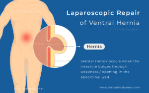 Is Ventral Hernia Repair a Major Surgery?